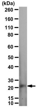 抗-p75NTR抗体，ICD serum, from rabbit