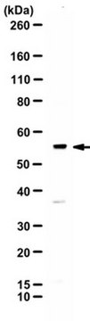 Anti-METTL14 Antibody from rabbit, purified by affinity chromatography