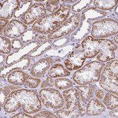 Anti-SLC13A1 antibody produced in rabbit Prestige Antibodies® Powered by Atlas Antibodies, affinity isolated antibody, buffered aqueous glycerol solution