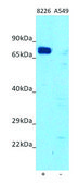 Anti-IL4I1 (C-terminal) antibody produced in rabbit affinity isolated antibody