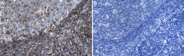 Anti-HLA-A Antibody, clone 2K7 ZooMAb&#174; Rabbit Monoclonal recombinant, expressed in HEK 293 cells