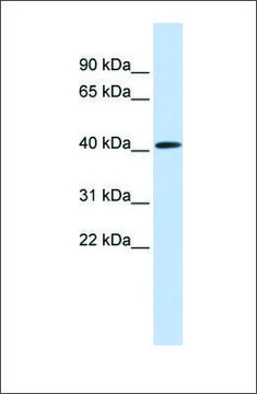 Anti-PARP11 antibody produced in rabbit affinity isolated antibody