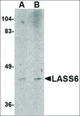 Anti-LASS6 antibody produced in rabbit affinity isolated antibody, buffered aqueous solution