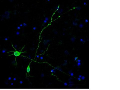 Milli-Mark&#174; FluoroPan Neuronal Marker - Alexa488 conjugated Milli-Mark FluoroPan Neuronal Marker -Alexa488 conjugated is an antibody targeting the FluoroPan Neuronal Marker protein, validated for use in ICC &amp; IF.