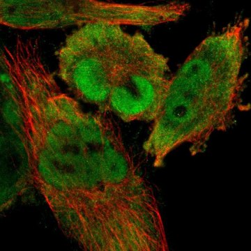 Anti-CDCA7 antibody produced in rabbit Prestige Antibodies&#174; Powered by Atlas Antibodies, affinity isolated antibody, buffered aqueous glycerol solution