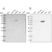 Anti-LRRC45 antibody produced in rabbit Prestige Antibodies® Powered by Atlas Antibodies, affinity isolated antibody, buffered aqueous glycerol solution, Ab2