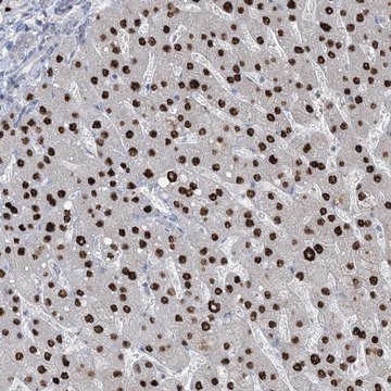 Anti-TFPT antibody produced in rabbit Prestige Antibodies&#174; Powered by Atlas Antibodies, affinity isolated antibody, buffered aqueous glycerol solution