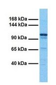 Anti-ADCY6 antibody produced in rabbit affinity isolated antibody