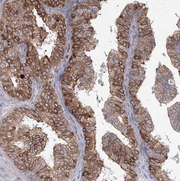 Anti-NHLRC2 antibody produced in rabbit Prestige Antibodies&#174; Powered by Atlas Antibodies, affinity isolated antibody, buffered aqueous glycerol solution