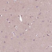 Anti-CCDC114 antibody produced in rabbit Prestige Antibodies® Powered by Atlas Antibodies, affinity isolated antibody, buffered aqueous glycerol solution