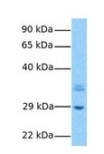 Anti-RPLP0 (AB2) antibody produced in rabbit IgG fraction of antiserum