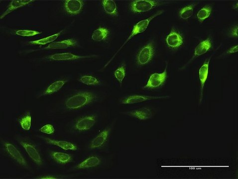 Anti-RPN2 antibody produced in rabbit purified immunoglobulin, buffered aqueous solution