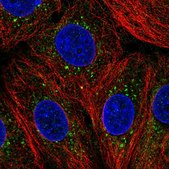 Anti-ZDHHC24 antibody produced in rabbit Prestige Antibodies® Powered by Atlas Antibodies, affinity isolated antibody, buffered aqueous glycerol solution