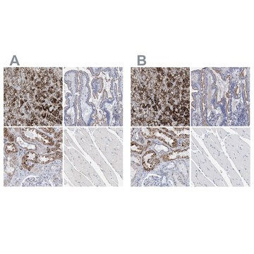 Anti-SGSH antibody produced in rabbit Prestige Antibodies&#174; Powered by Atlas Antibodies, affinity isolated antibody, buffered aqueous glycerol solution, Ab2