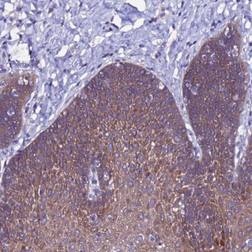 Anti-ARHGEF35 antibody produced in rabbit Prestige Antibodies&#174; Powered by Atlas Antibodies, affinity isolated antibody, buffered aqueous glycerol solution