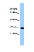 Anti-RAB1A antibody produced in rabbit affinity isolated antibody