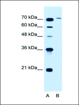 Anti-SLCO6A1 (AB1) antibody produced in rabbit IgG fraction of antiserum