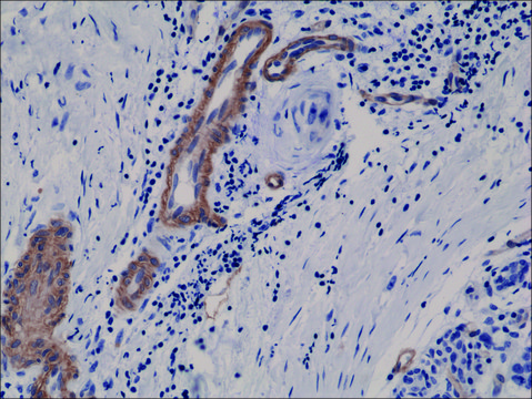 Anti-CD146 antibody, Rabbit monoclonal recombinant, expressed in HEK 293 cells, clone RM249, purified immunoglobulin