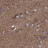 Anti-SUCLA2 antibody produced in rabbit Prestige Antibodies® Powered by Atlas Antibodies, affinity isolated antibody