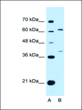 Anti-IL28RA antibody produced in rabbit affinity isolated antibody