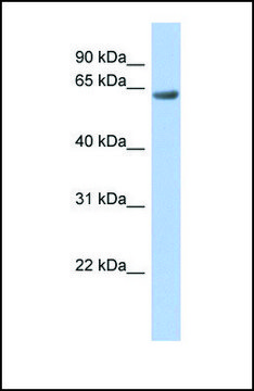 Anti-TBC1D10B antibody produced in rabbit affinity isolated antibody