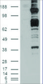 Anti-CARD11 antibody produced in goat affinity isolated antibody, buffered aqueous solution