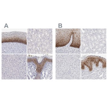 Anti-LY6D antibody produced in rabbit Prestige Antibodies&#174; Powered by Atlas Antibodies, affinity isolated antibody, buffered aqueous glycerol solution