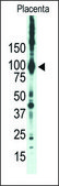 Anti-PKCε (N-term) antibody produced in rabbit IgG fraction of antiserum, buffered aqueous solution
