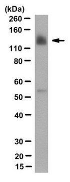 Anti-TTBK1 Antibody, clone F287-1.1-1E9 clone F287-1.1-1E9, from mouse