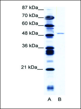 Anti-ZNF627 antibody produced in rabbit affinity isolated antibody