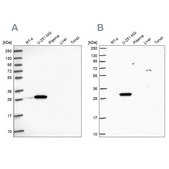 Anti-RPL8 antibody produced in rabbit Prestige Antibodies® Powered by Atlas Antibodies, affinity isolated antibody, buffered aqueous glycerol solution
