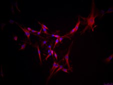 YUMM 1.1 Mouse Melanoma Cell Line