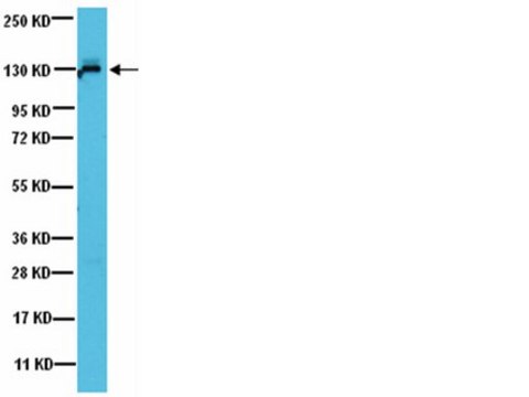 Anti-JAK1 Antibody from rabbit, purified by affinity chromatography