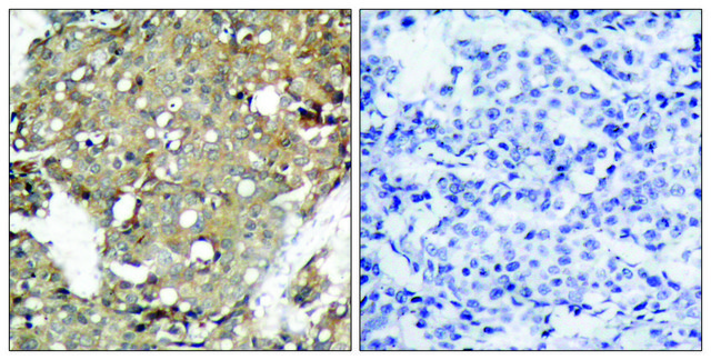 Anti-STAT1 antibody produced in rabbit affinity isolated antibody