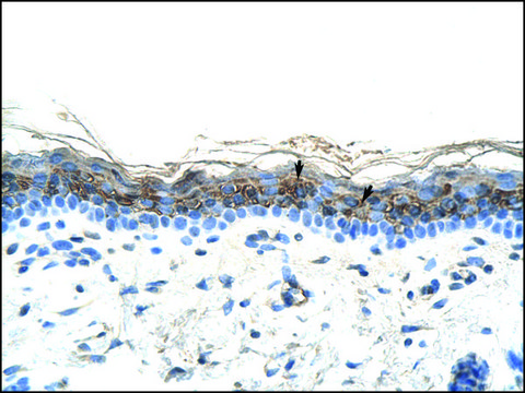 抗-ZIC2 兔抗 affinity isolated antibody