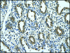 抗-MMP1 IgG fraction of antiserum