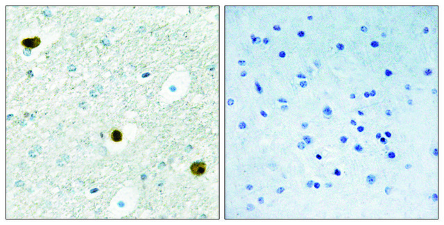 Anti-TPD52 antibody produced in rabbit affinity isolated antibody