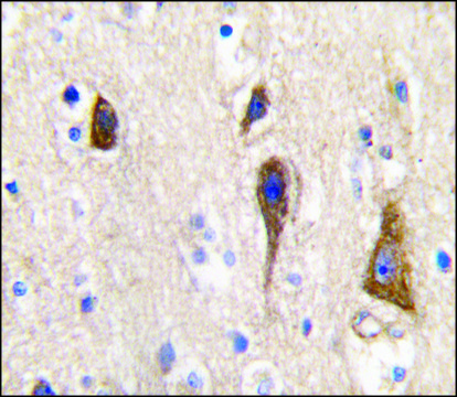 Anti-CYP2R1 (center) antibody produced in rabbit saturated ammonium sulfate (SAS) precipitated, buffered aqueous solution