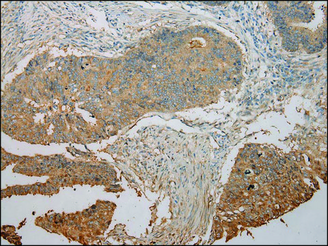 Anti-UBE2B affinity isolated antibody