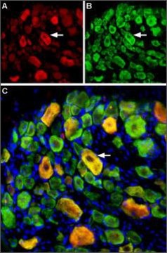 Anti-Sodium Channel ASIC3 antibody produced in rabbit affinity isolated antibody, lyophilized powder