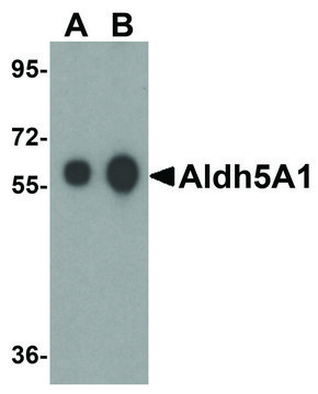 Anti-ALDH5A1 antibody produced in rabbit affinity isolated antibody, buffered aqueous solution