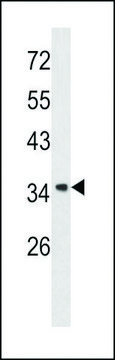 ANTI-ANNEXIN A1 (CENTER) antibody produced in rabbit purified immunoglobulin, buffered aqueous solution