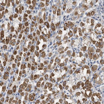 抗-DHX58 兔抗 Prestige Antibodies&#174; Powered by Atlas Antibodies, affinity isolated antibody, buffered aqueous glycerol solution, Ab2