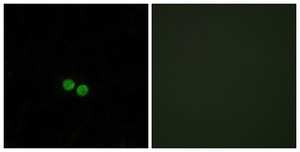 Anti-CDC25C antibody produced in rabbit affinity isolated antibody