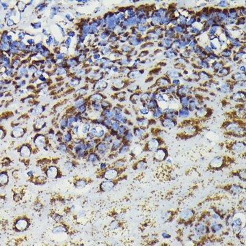 Anti-SOD2 antibody produced in rabbit