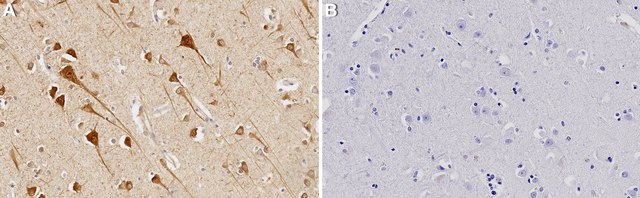 Anti-CYP46A1 Antibody, clone 1C20 ZooMAb&#174; Rabbit Monoclonal recombinant, expressed in HEK 293 cells