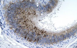 Anti-ECM1 Antibody, clone 1C6 ZooMAb® Rabbit Monoclonal recombinant, expressed in HEK 293 cells