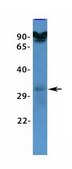 Anti-VDAC3, (N-terminal) antibody produced in rabbit affinity isolated antibody