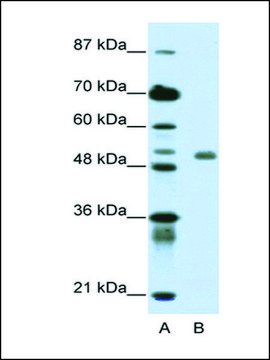 Anti-DEAF1 (AB1) antibody produced in rabbit affinity isolated antibody