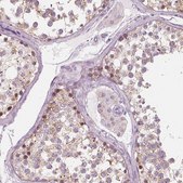 抗-PRAME 兔抗 Prestige Antibodies® Powered by Atlas Antibodies, affinity isolated antibody, buffered aqueous glycerol solution